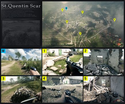 圣康坦的伤痕（St. Quentin Scar）。